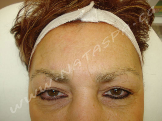 Permanent Makeup, Before and After, Toronto, Concord ...